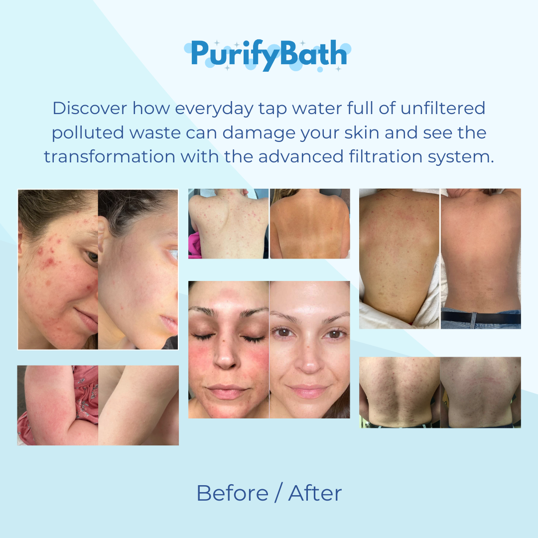 PurifyBath Filtered Showerhead